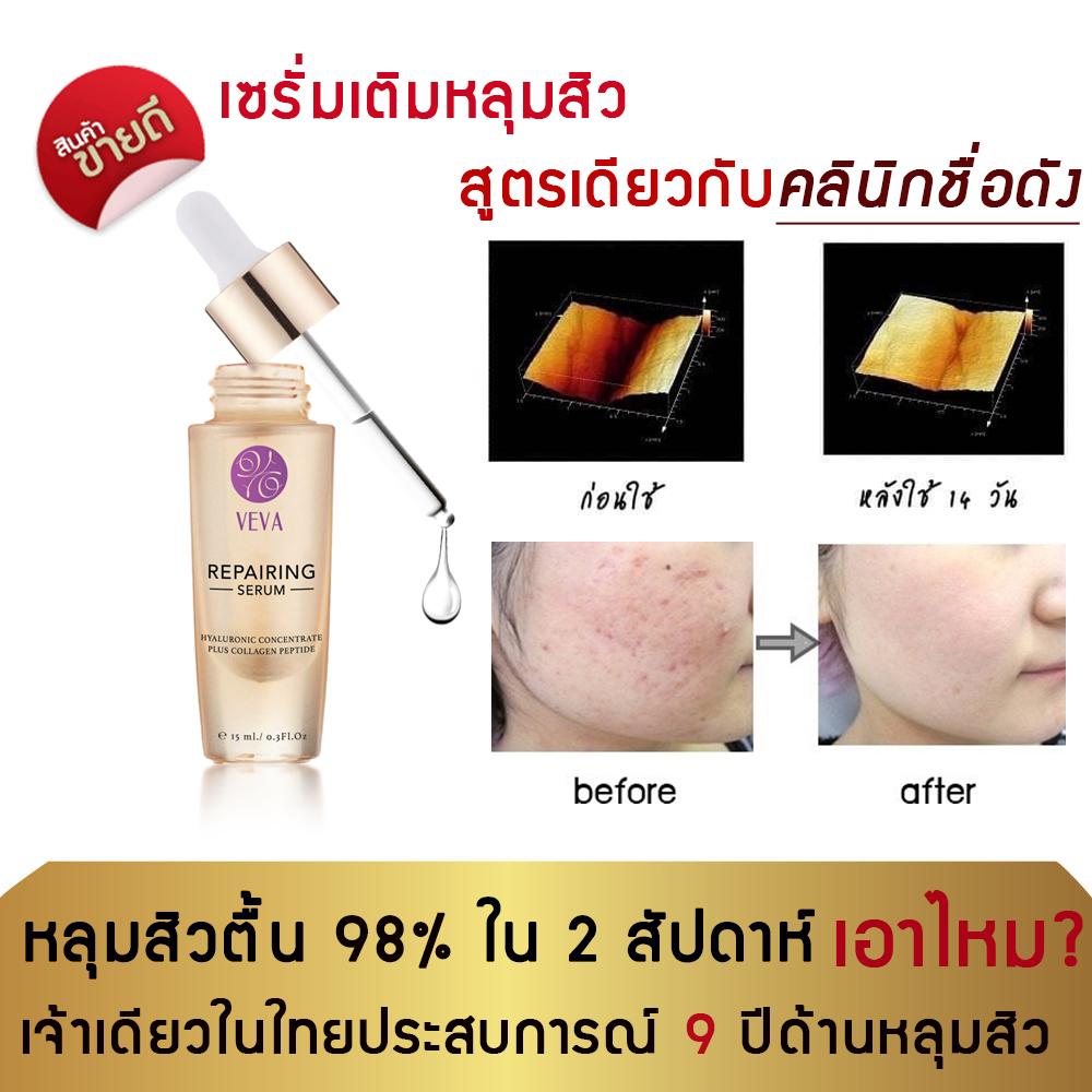 VEVA Repairing Serum เซรั่มเรียกเนื้อหลุมสิว หน้าหลุมรอยสิว รอยดำ รอยแดง เติมเต็มหลุมสิวให้เรียบเนียน 15ml. ราคา 690 บาท*ส่งฟรี