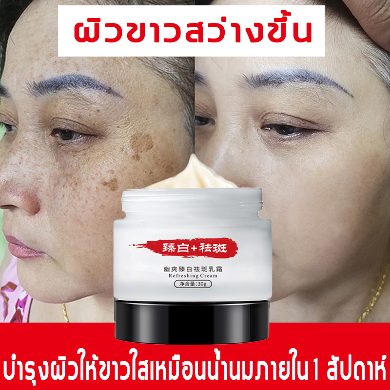 Lisa Refreshing Cream 30g ครีมทาฝ้า ครีมแก้ฝ้า ครีมทาฝ้ากระ ลดปัญหาสีผิวคล้ำ ลดการสร้างสีผิว สำหรับผิวแพ้ง่าย