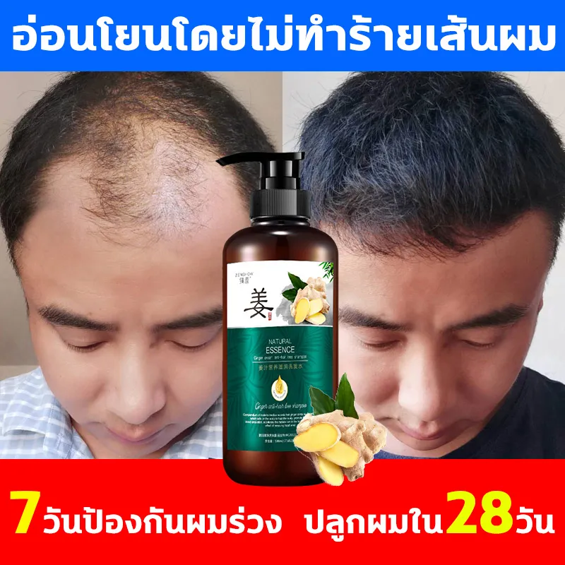 500MLแชมพูขิง แชมพูแก้ผมร่วง แชมพูสมุนไพร แชมพูชายหญิง แชมพูเร่งผมยาว แชมพูแก้ผมหงอก แชมพู ป้องกัน ร่วง แชมพูขจัดรังแค แชมพูสระผม ป้องกันผมร่วง ขิงช่วยป้องกันผมร่วง ยาสระผมแก้ร่วง แชมพูขิงเพียว Ginger Shampoo Anti-hair Loss Herbal Hair