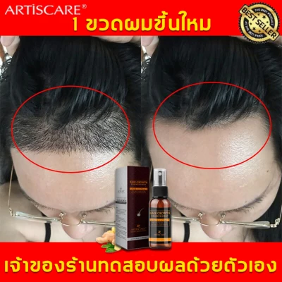 ARTISCARE น้ำยาปลูกผม30ml ช่วยปรับปรุงผมร่วง เร่งการเจริญเติบโตของเส้นผม(ยาปลูกผมของแท้ เซรั่มปลูกผม เซรั่มบำรุงผม,ปลูกผม,น้ำยาปลูกผม สำหรับผมบาง นีโอแฮร์ของแท้ สเปรย์ปลูกผม น้ำยาปลูกผมชาย ปลูกผมเร่งด่วน น้ำยาเร่งผมยาว น้ำยาใส่ผม)