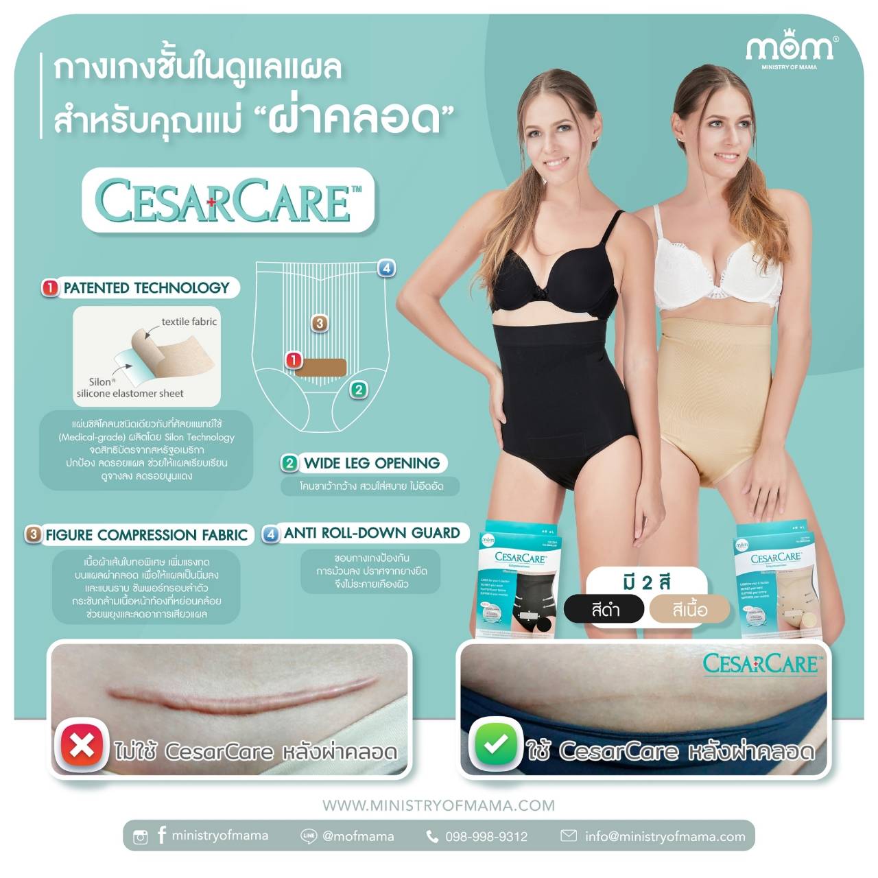 Ministry of Mama - CesarCare ชั้นในดูแลแผลผ่าคลอด ราคา 1,590 บาท*ส่งฟรี