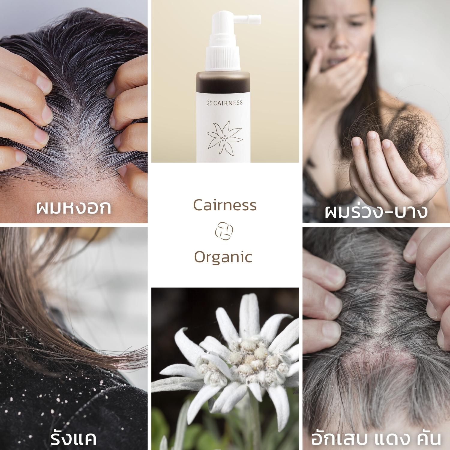 โทนิคแครเนส สมุนไพรเข้มข้น ✨ผมหงอก✨ผมบาง✨ผมร่วงCairness Organic Edelweiss Herbal Hair Tonic ลดรังแค หัวล้าน คันศีรษะ