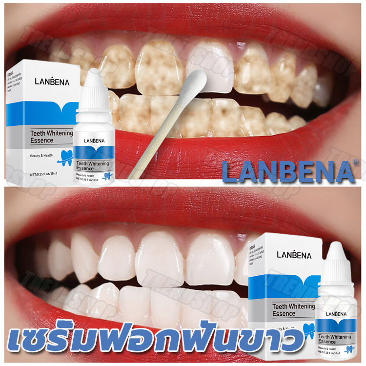 【ยอดขายดีที่สุดในลาซาด้า】ทันตแพทย์แนะนำLANBENAฟอกฟันขาวแท้ ยาฟอกฟันขาว ขจัดคราบหินปูน คราบจุลินทรีย์ น้ำยาฟอกสีฟัน ยาสีฟันฟันขาว ฟันขาว ยาแก้ปวดฟัน ยาสีฟันพาโรดอน ชุดฟอกสีฟันขาว น้ำยาฟอกฟันขาว ยาสีฟันขจัดปูน ปากเหม็น ยาสีฟัน ฟันเหลือง กำจัดกลิ่นปาก Teeth