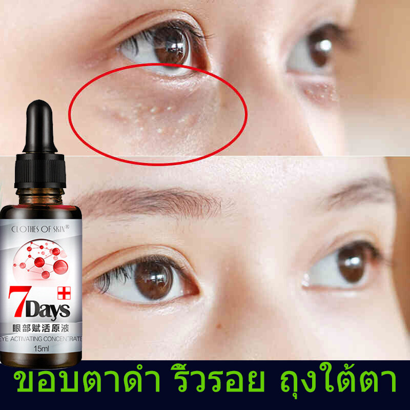 CLOIHES OF SKIN YEY ACTIVATING CONCENTRATE ทำให้ดวงตาผ่อนคลาย ลดความาร์คใต้ตาดำ ลดถุงใต้ตา ยกกระชับ ลดอาการบวม กำจัดไขมัน ลดริ้วรอยมาร์คใต้ตา