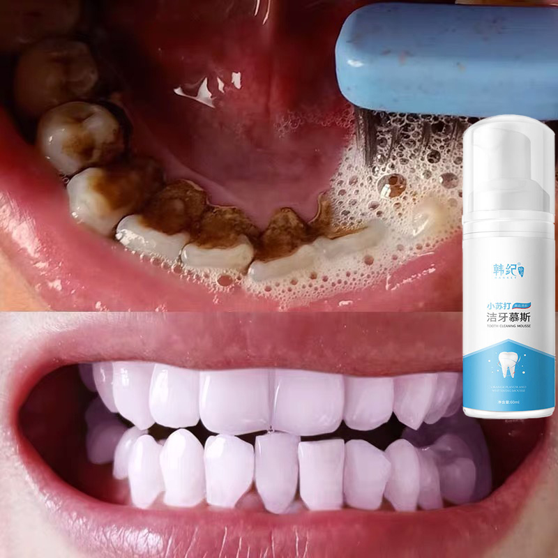 ยาสีฟัน มูสแปรงฟัน  Teeth Whitening Mousse Foam น้ำยาฟอกสีฟัน เซรั่มฟอกฟันขาว บำรุงฟัน แก้ฟันเหลือง ขัดคราบเหลืองคราบพฟัน ดับกลิ่นปาก สดชื่น
