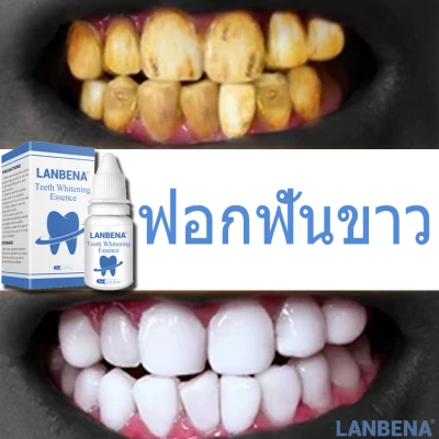 NEW Smile more confident LANBENA teeth whitening serum, teeth whitening, black teeth, yellow teeth, tartar removal caused by Drink coffee or tea Clean the mouth Remove Plaque, Teeth Whitening, Beautiful Toothpaste tool, Teeth Whitening, Bleaching, Teeth W