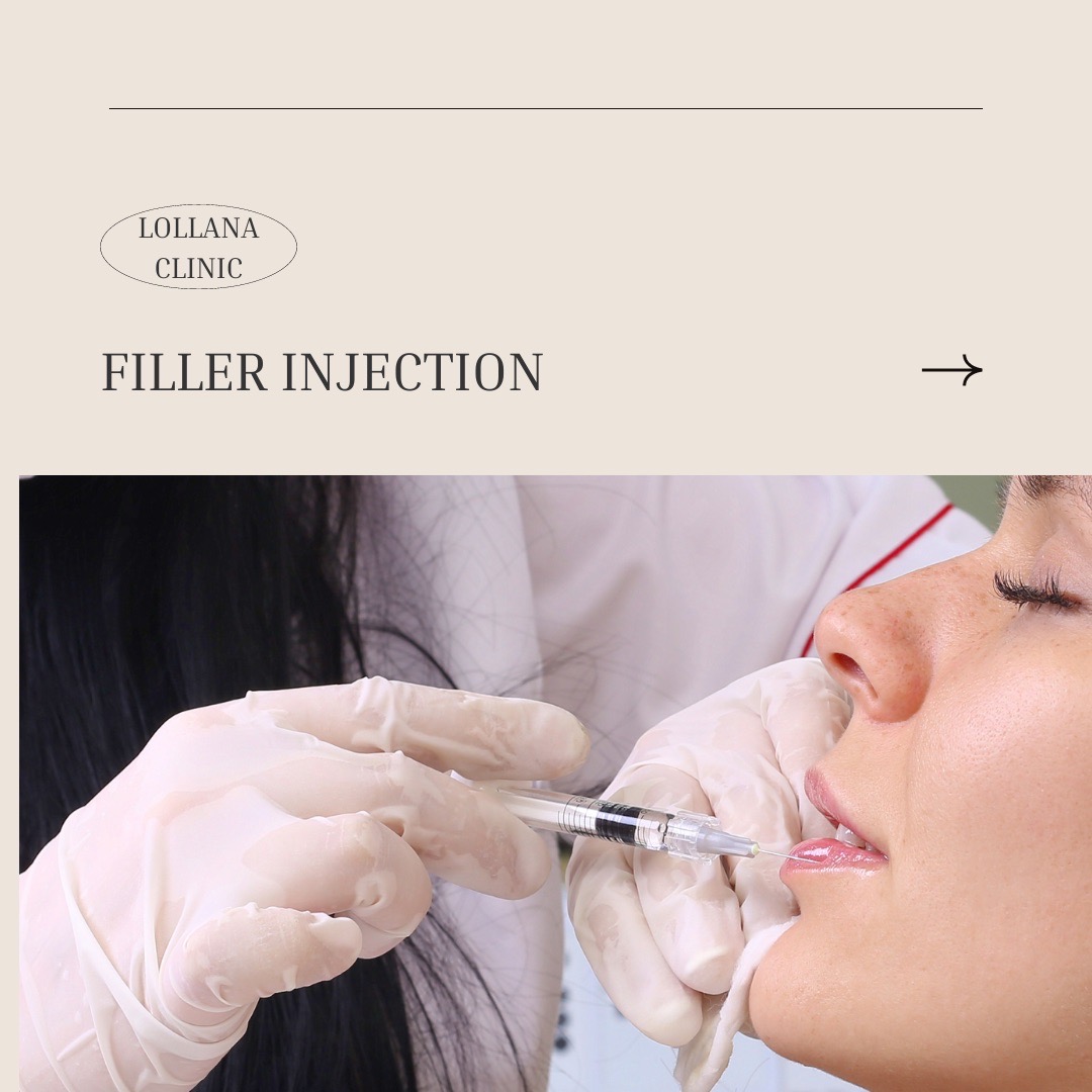 (Digital coupon) Lollana clinic Filler Neuramis 1 cc Chin 6900 THB ดิจิทัลคูปอง Lollana clinic ฟิลเลอร์คาง นิวรามิส 1 ซีซี 6900 บาท ราคา 5,900 บาท*ส่งฟรี