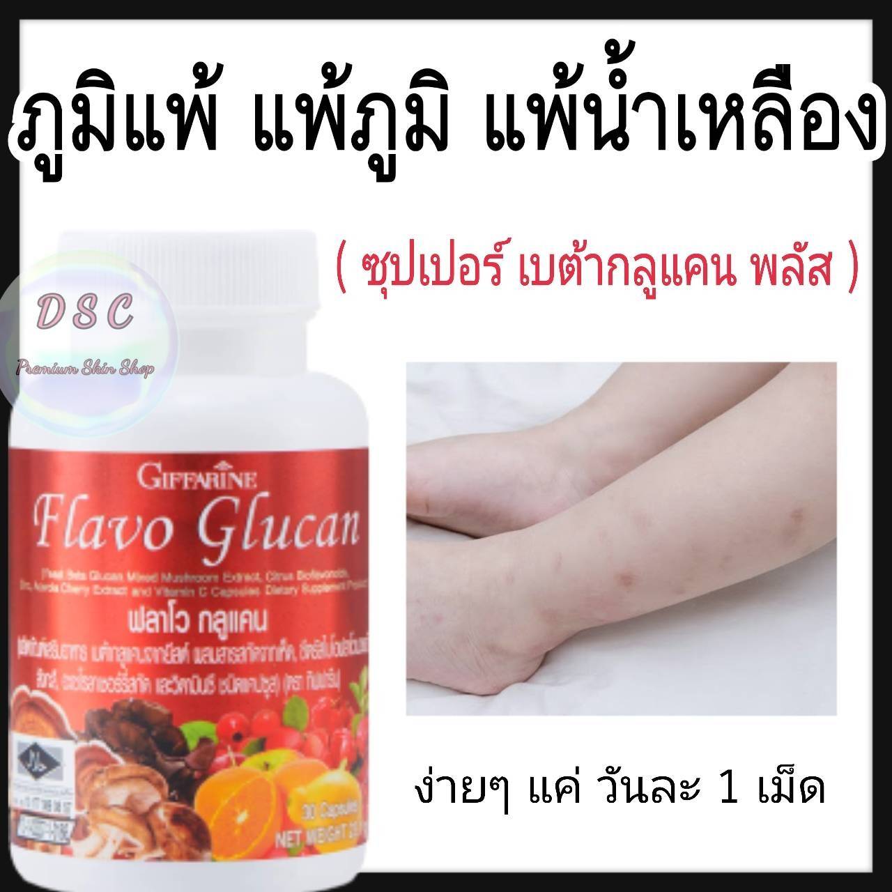 อาหารเสริม วิตามินบำรุงสุขภาพร่างกาย SUPPLEMENT ส่งฟรี ขายดี วิตามินภูมิแพ้ วิตามินรมพิษผื่นคัน สระเก็ดเงิน ซุปเปอร์ เบต้ากลูแคน วิตามินซี