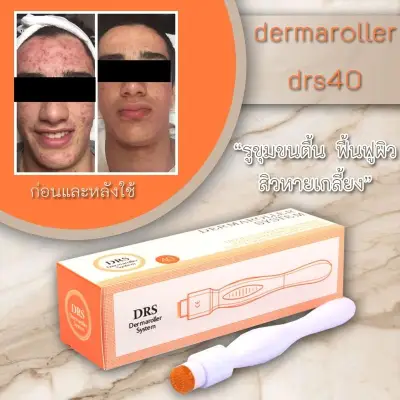 เดอร์มาแสตมป์ ปากกาเข็มรักษาหลุมสิว รูขุมขนกว้าง รอยดำ รอยแดง (ขนาด 1.50 mm) DRS Derma Stamp Micro Needle Pen 40