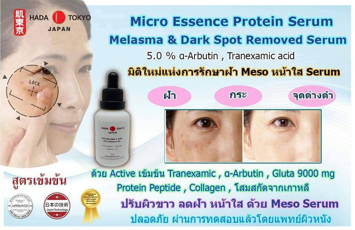 ครีมหมอญี่ปุ่น Hada Tokyo เซรัมขาวใส เข้มข้นเฉพาะที่ รักษาฝ้า จุดด่างดำ เฉพาะจุด ราคา 870 บาท*ส่งฟรี