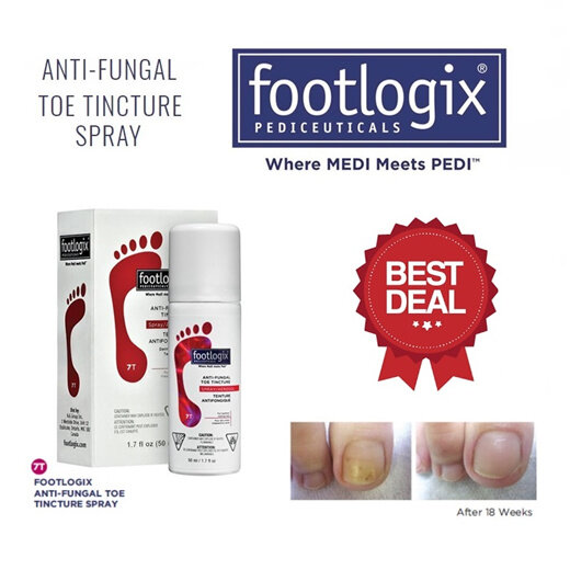 Footlogix 7T Nail Tincture Spray anti fungal infection anti-microbial 50ml red ฟุตโลจิสต์ สเปรย์รักษาเชื้อรา เล็บเท้า เล็บเหลือง บำรุงเล็บ กล่องสีแดง