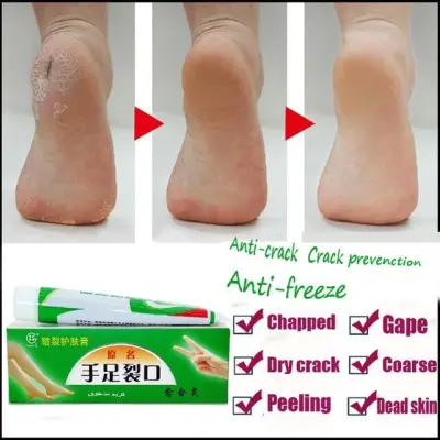 ครีมทาส้นเท้าแตก ครีมทาส้นเท้า ครีมบำรุงเท้า ครีมบำรุงส้นเท้า Hand Foot Crack Cream Heel Chapped Peeling Repair Anti Dry Crack Winter Feet Care Chinese Medicinal Ointment Cream