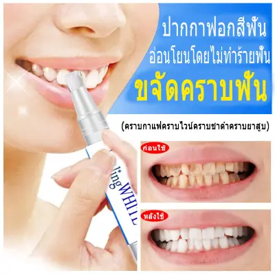 ฟอกฟันขาว น้ำยาฟอกฟันขาว เจลฟอกฟันขาว teeth whitening ฟอกสีฟันปากกาบำรุงฟัน ขจัดฟันเหลืองฟันดำดับกลิ่นปากช่วยให้ฟันขาว