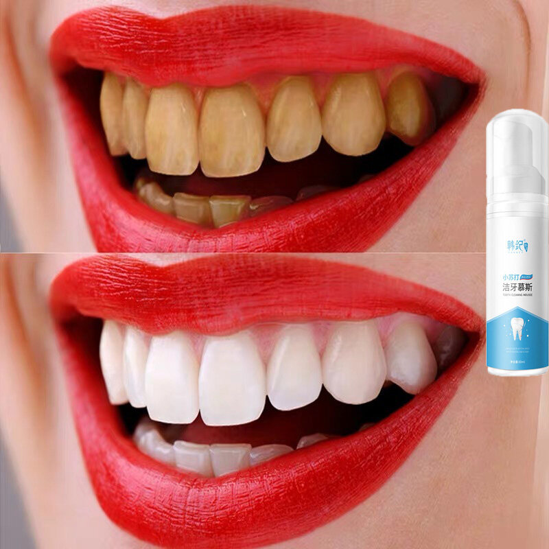 ยาฟอกฟันขาว ฟอกฟันขาวแท้ ยาสีฟัน มูสแปรงฟัน น้ำยาฟอกสีฟัน Teeth Whitening Mousse Foam เจลฟอกฟันขาวเซรั่มไวท์เทนนิ่งสำหรับฟอกฟันขาว บำรุงฟัน