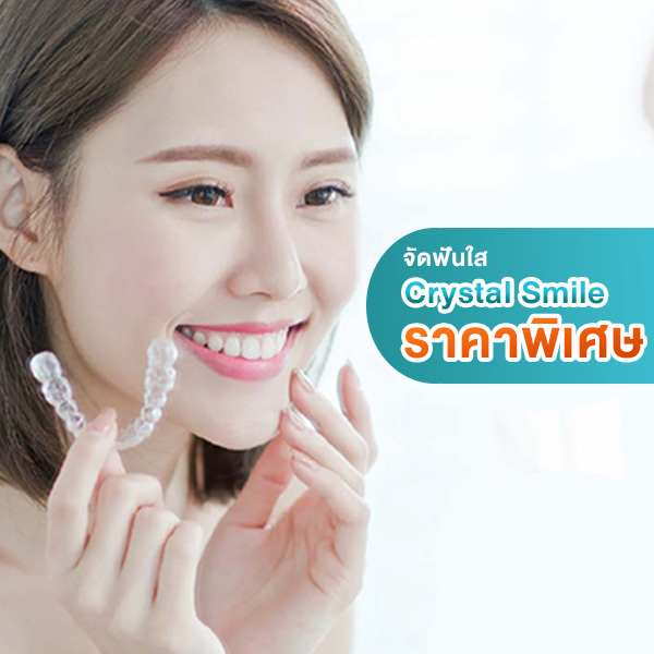Bangkok Smile MALO Dental : จัดฟันใส Crystal Smile