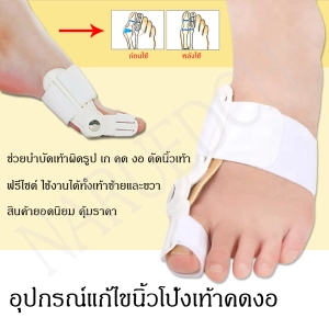 สินค้า เฝือกอ่อน อุปกรณ์แก้ไขเท้าผิดรูป (สำหรับผู้มีนิ้วโป้งเท้าเอียง) คดงอ ดัดเท้า เท้าเก เท้าเอียง ฟรีไซร์ x 2 ชิ้น (1 คู่) พร้อมส่ง คุ้มราคา