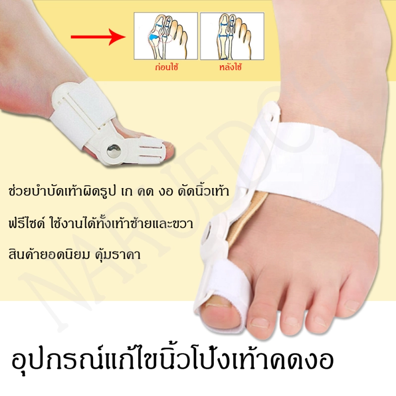 ภาพหน้าปกสินค้าเฝือกอ่อน อุปกรณ์แก้ไขเท้าผิดรูป (สำหรับผู้มีนิ้วโป้งเท้าเอียง) คดงอ ดัดเท้า เท้าเก เท้าเอียง ฟรีไซร์ x 2 ชิ้น (1 คู่) พร้อมส่ง คุ้มราคา
