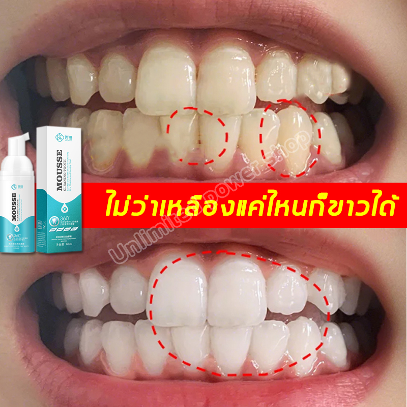 ออกจากบ้านต้องพก ยาสีฟัน+น้ำยาบ้วนปาก 2 in 1 ยาสีฟันฟอกขาว 10 เติมลมหายใจ ทำความสะอาดช่องปากในไม่กี่วินาที ฟอกฟันขาว หินปูน ฟอกสีฟัน ขจั ฟัน ฟันขาว ยาสีฟันฟันขาว