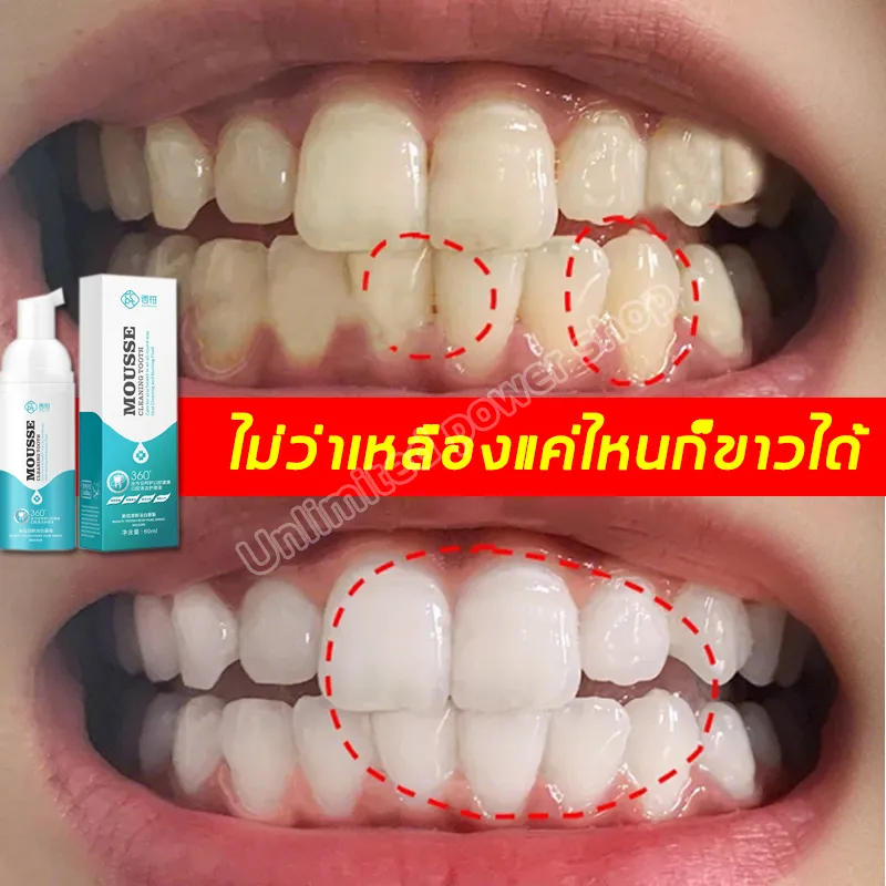 ออกจากบ้านต้องพก ยาสีฟัน+น้ำยาบ้วนปาก 2 in 1 ยาสีฟันฟอกขาว 10 เติมลมหายใจ ทำความสะอาดช่องปากในไม่กี่วินาที ฟอกฟันขาว หินปูน ฟอกสีฟัน ขจั ฟัน ฟันขาว ยาสีฟันฟันขาว