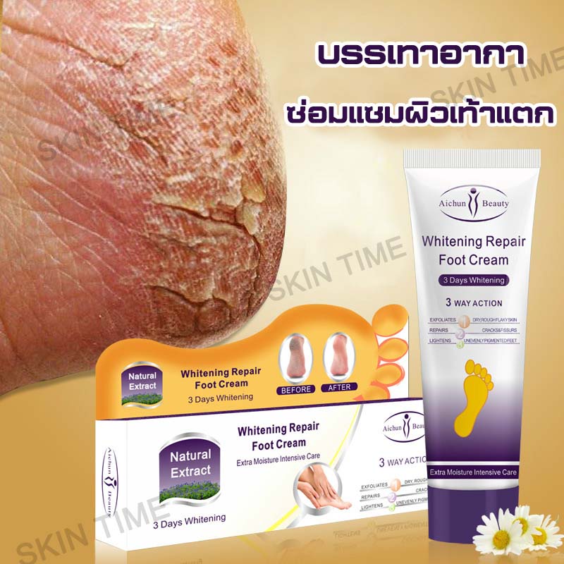 Aichun ดูแลเท้า ดูแลมือ ครีมทาเท้าแตก Skin Care Foot care บำรุงโดยโภชนาการ ครีมบำรุงเท้า กระจ่างใส กักเก็บน้ำ ช่วยให้ผิวเท้าเนียนนุ่ม