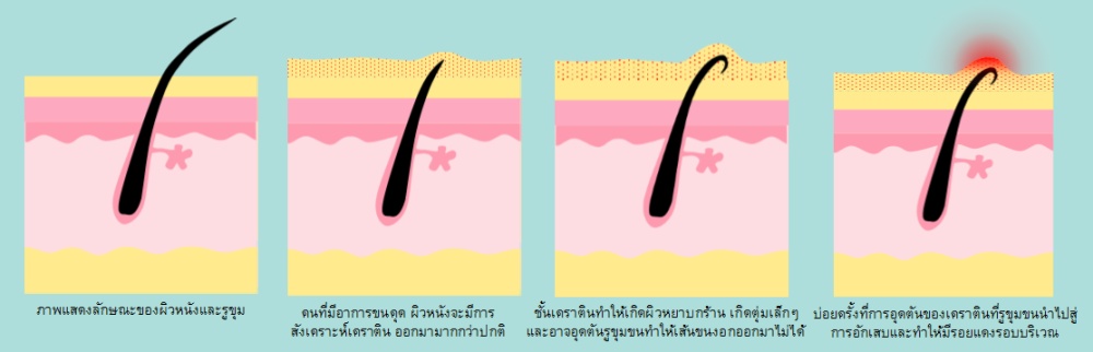 image/