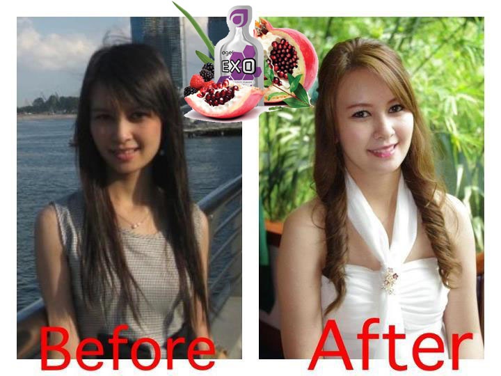 201-EXO-beforeafter-period